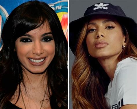 anitta antes e depois.